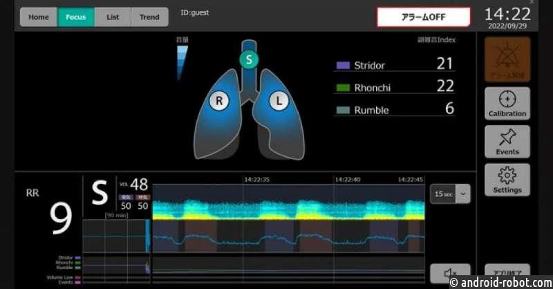 Новое устройство отслеживает звуки дыхания для прогнозирования дыхательной недостаточности