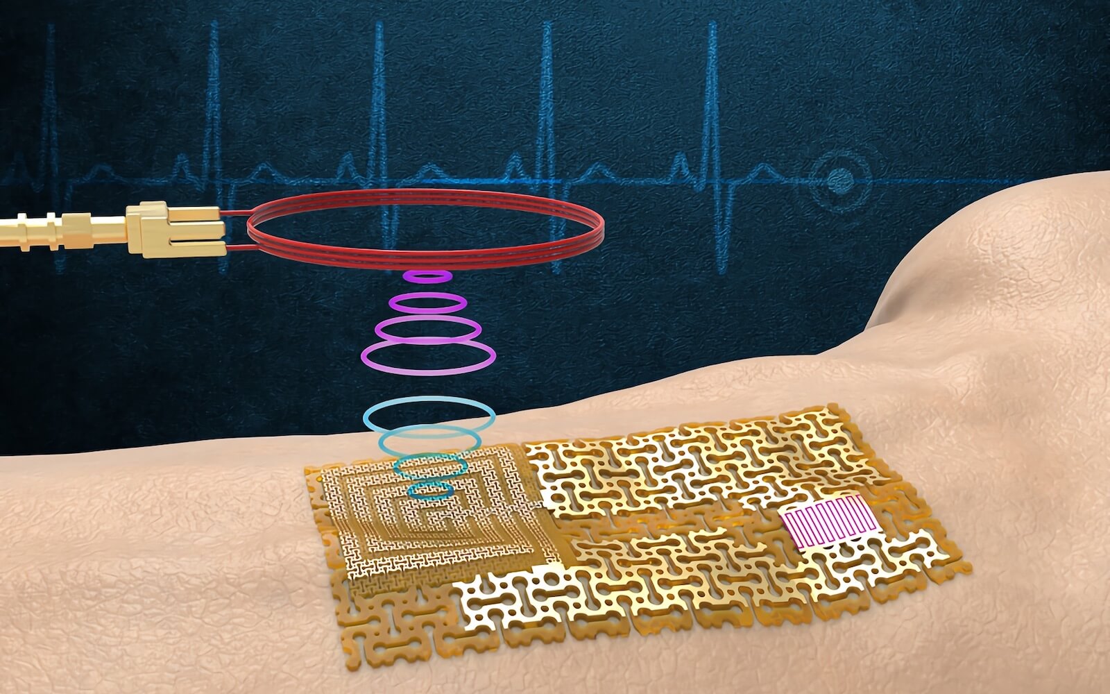 Ученые из MIT изготовили кожные датчики без чипов и батареек с возможностью беспроводной связи