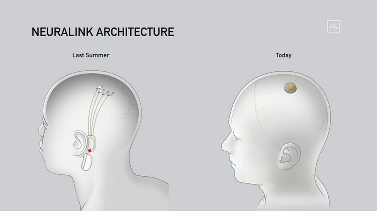 Илон Маск показал новую версию Neuralink и чипированную свинью